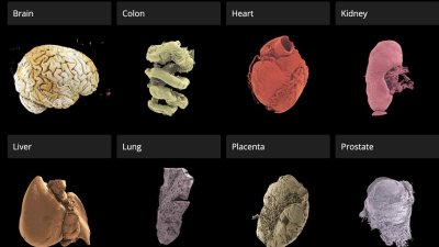 Atlas de Órganos Humanos: Ya se puede acceder al "google earth" del cuerpo