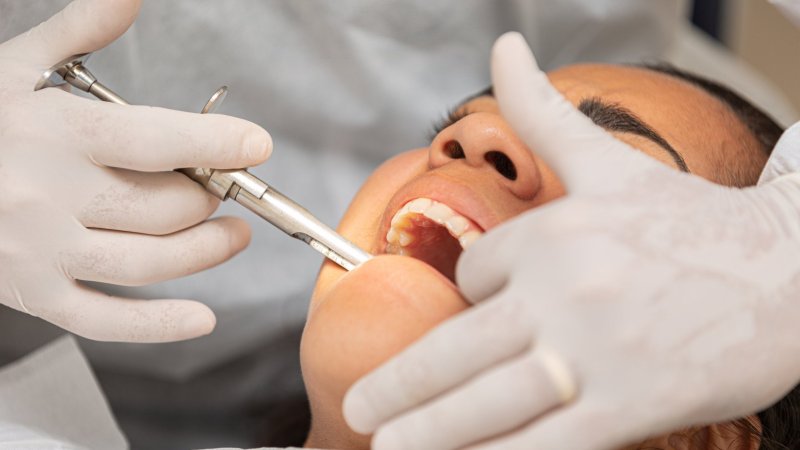 ¿Una infección de muela puede deformar el brazo? Dentista explica por qué se generó este extraño caso médico